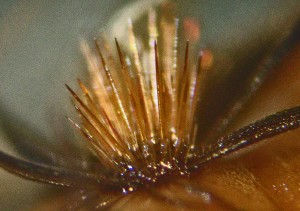 Puss Caterpillar Verrucae