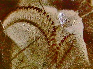 Puss Caterpillar Leg Micrograph