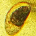 Chironomid Egg under Magnification--Southeast Texas Marina--03 September 2010