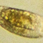 Chironomid Egg with developing larva under Magnification--Southeast Texas Marina--03 September 2010