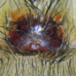 Brown Spider; Annie P,, NW Austin, TX; Epigynum