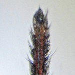 Brown Spider; Annie P,, NW Austin, TX; Distal Tarsus, Leg I