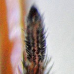 Brown Spider; Annie P,, NW Austin, TX; Dorsal Tarsus, Leg II